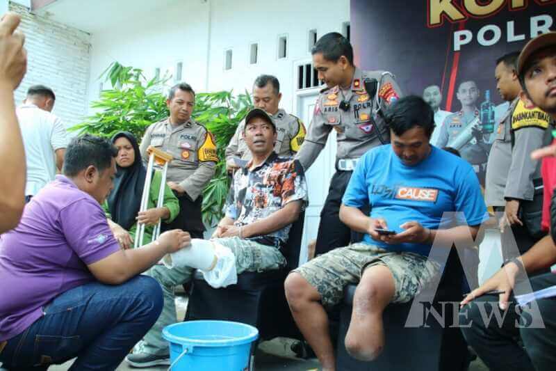 Polresta Malang Kota beri kaki palsu untuk Disabilitas