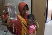 Pasien bibir sumbing usai dioperasi