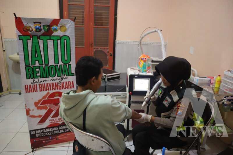 Polres Situbondo gelar hapus tato gratis